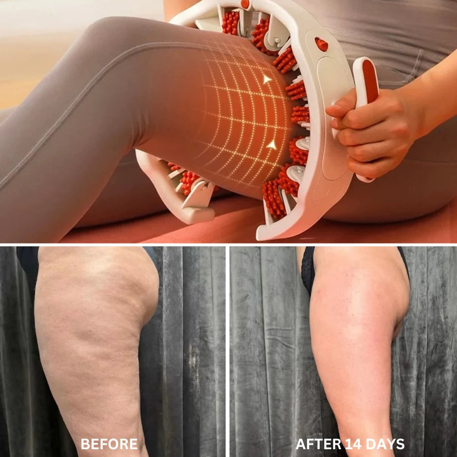 Deep Tissue Massage Roller™